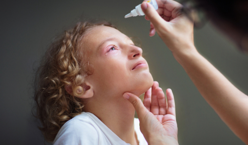 Bambino con congiuntivite allergica usa gocce oculari con l'aiuto della mamma